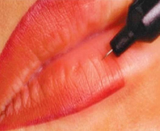 relleno de labios